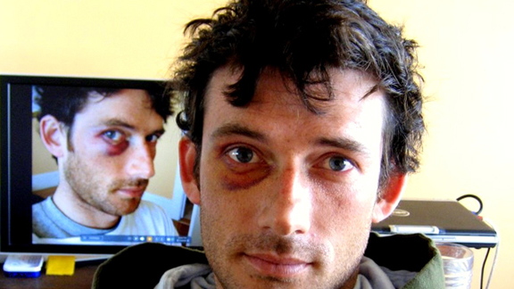 as_surf_lewis_blackeye_576.jpg